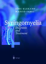 Syringomyelia
